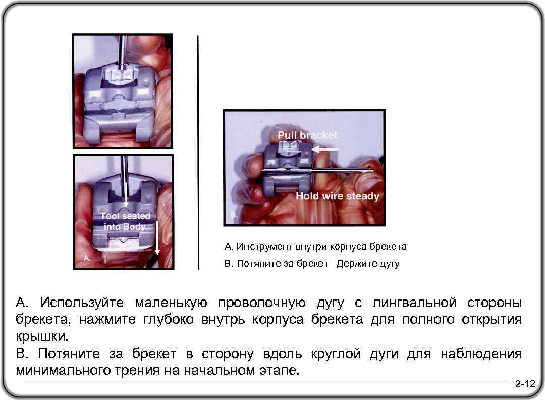 Hold wire steady А. Инструмент внутри корпуса брекета B. Потяните за брекет Держите дугу