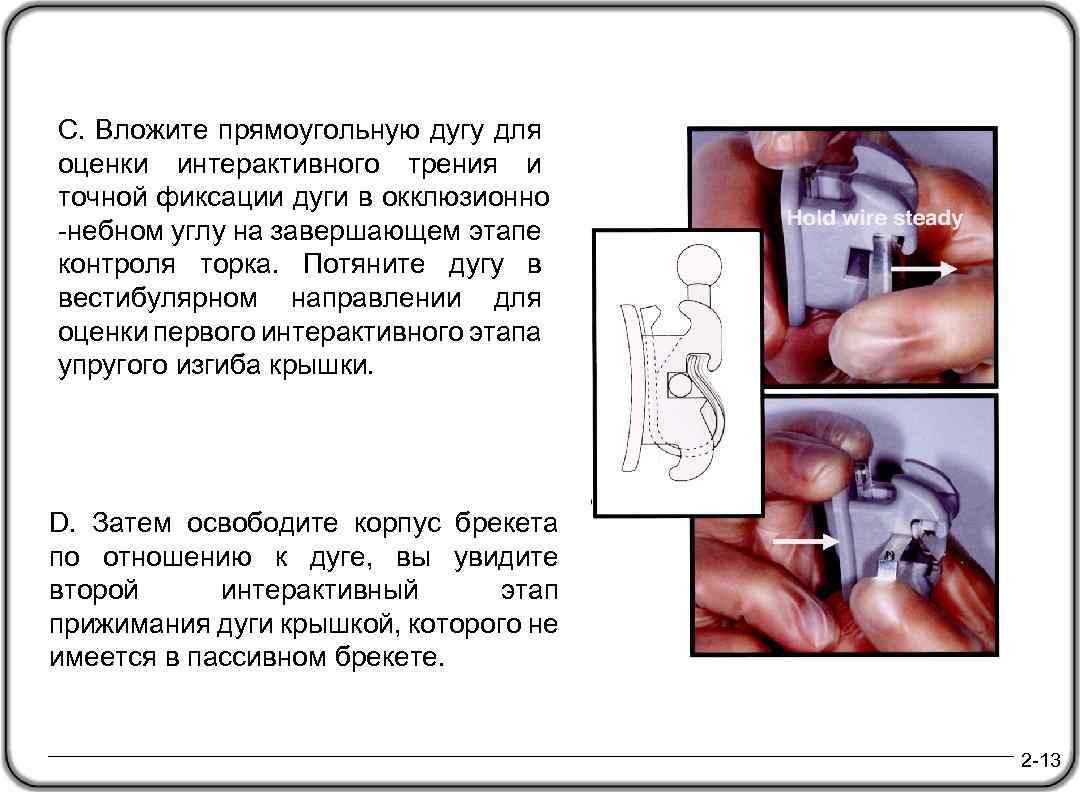 C. Вложите прямоугольную дугу для оценки интерактивного трения и точной фиксации дуги в окклюзионно