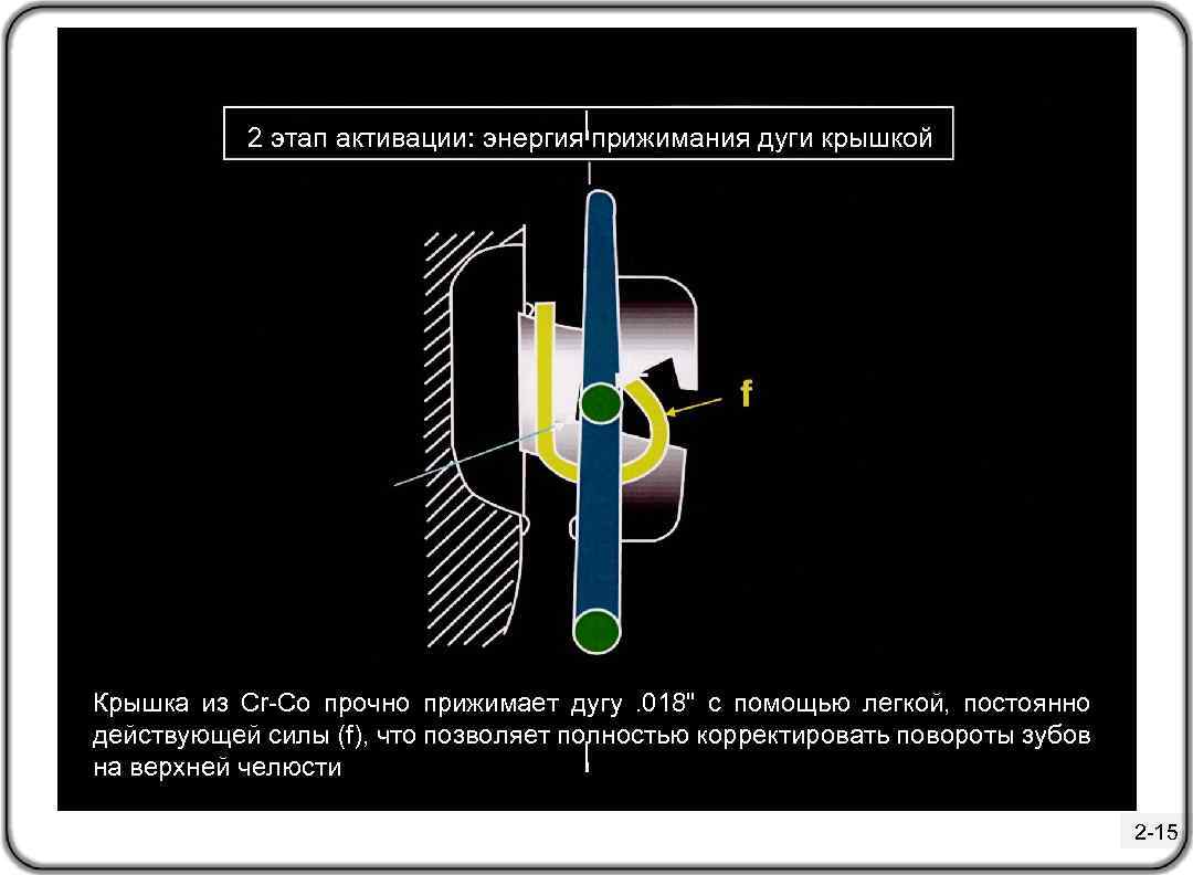 2 этап активации: энергия прижимания дуги крышкой Крышка из Cr-Co прочно прижимает дугу .