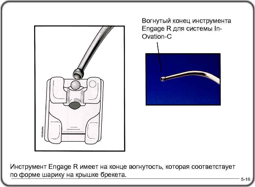 Вогнутый конец инструмента Engage R для системы In. Ovation-C Инструмент Engage R имеет на