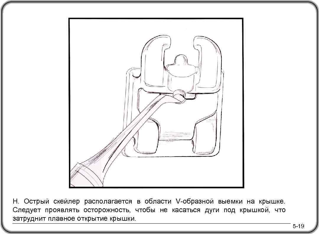 H. Острый скейлер располагается в области V-образной выемки на крышке. Следует проявлять осторожность, чтобы