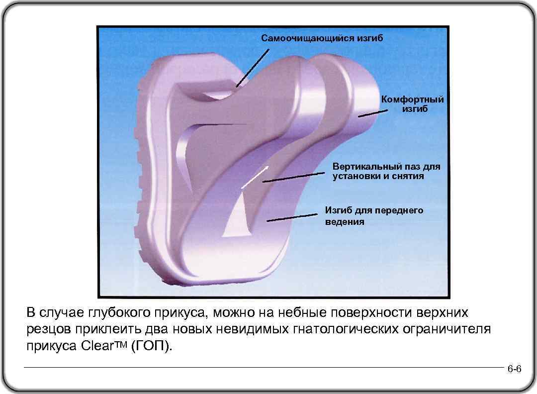 Самоочищающийся изгиб Комфортный изгиб Вертикальный паз для установки и снятия Изгиб для переднего ведения