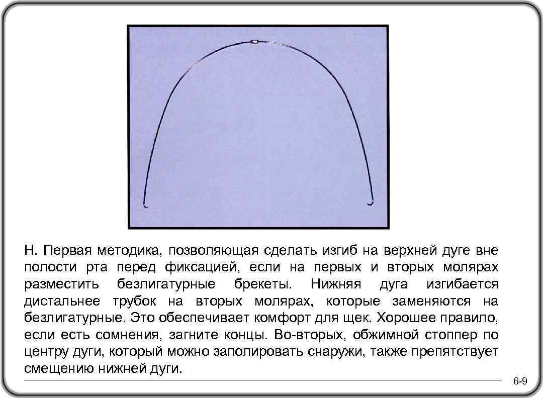 H. Первая методика, позволяющая сделать изгиб на верхней дуге вне полости рта перед фиксацией,