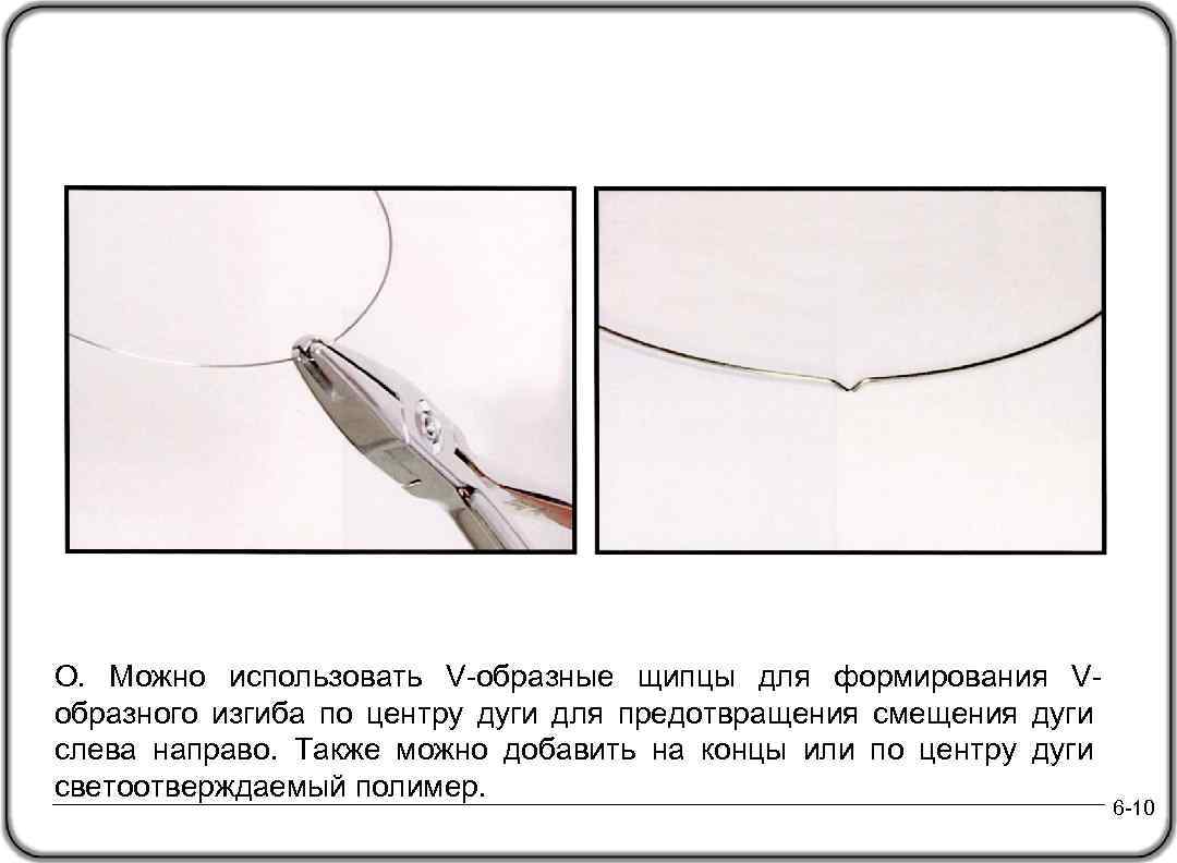 O. Можно использовать V-образные щипцы для формирования Vобразного изгиба по центру дуги для предотвращения