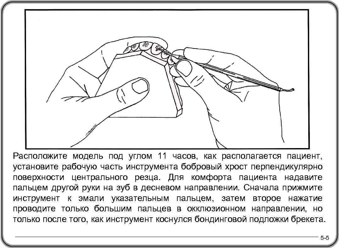 Расположите модель под углом 11 часов, как располагается пациент, установите рабочую часть инструмента бобровый