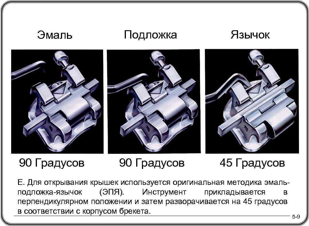 Эмаль Подложка Язычок 90 Градусов 45 Градусов E. Для открывания крышек используется оригинальная методика