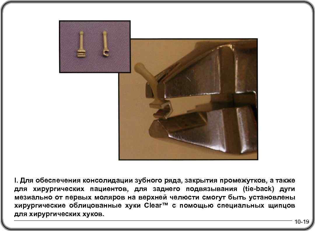 I. Для обеспечения консолидации зубного ряда, закрытия промежутков, а также для хирургических пациентов, для