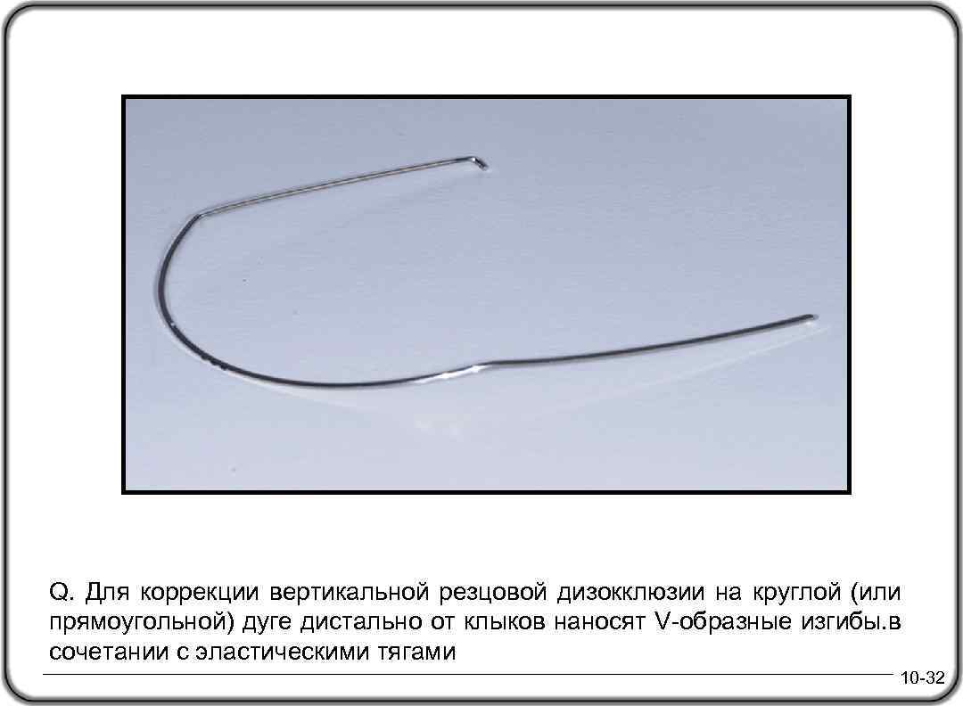 Q. Для коррекции вертикальной резцовой дизокклюзии на круглой (или прямоугольной) дуге дистально от клыков