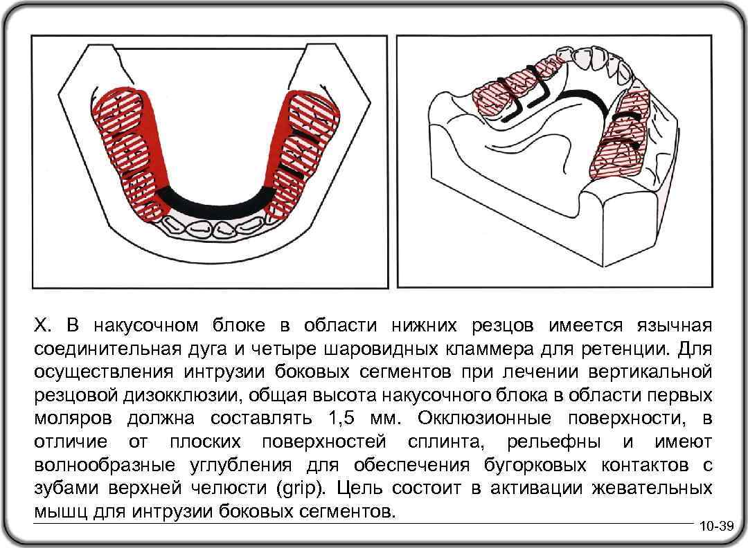 Х. В накусочном блоке в области нижних резцов имеется язычная соединительная дуга и четыре