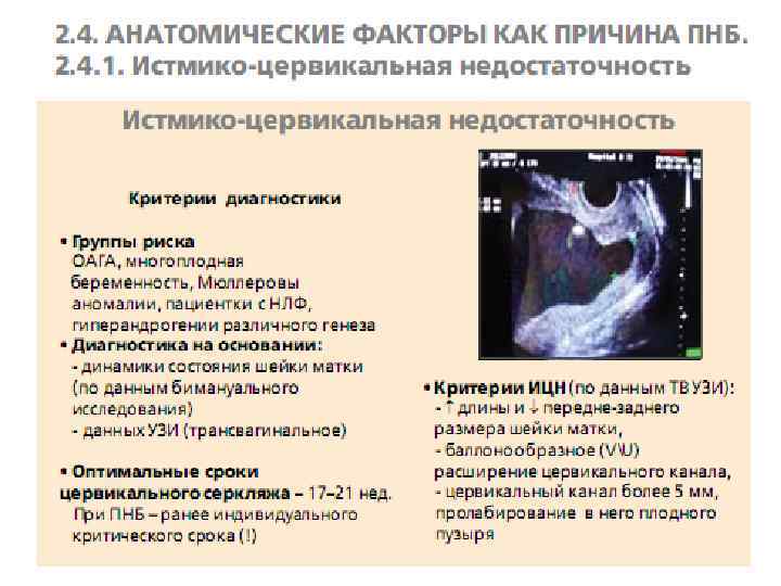 Пролабирование плодного пузыря. Истмико-цервикальная недостаточность на УЗИ. Критерии истмико цервикальной недостаточности. Ультразвуковые критерии ИЦН. Критерии ИЦН при беременности.