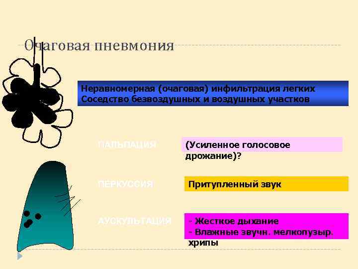 Очаговая пневмония Неравномерная (очаговая) инфильтрация легких Соседство безвоздушных и воздушных участков ПАЛЬПАЦИЯ (Усиленное голосовое