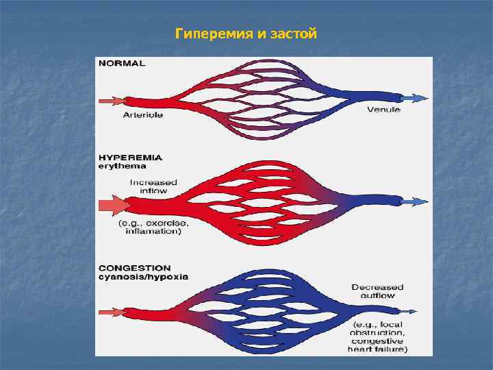 Гиперемия и застой 
