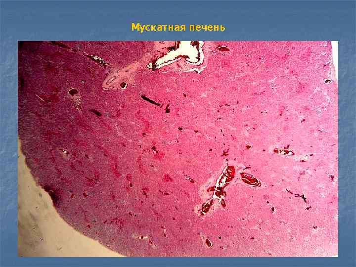 Мускатная печень 