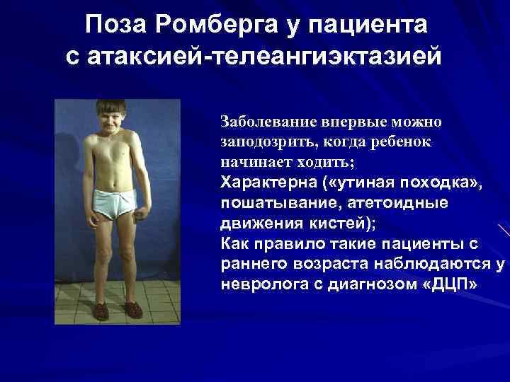 Поза Ромберга у пациента с атаксией-телеангиэктазией Заболевание впервые можно заподозрить, когда ребенок начинает ходить;