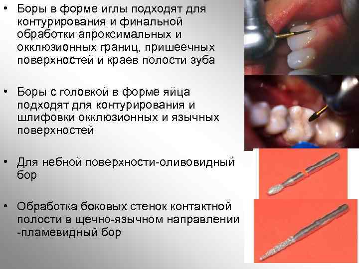  • Боры в форме иглы подходят для контурирования и финальной обработки апроксимальных и