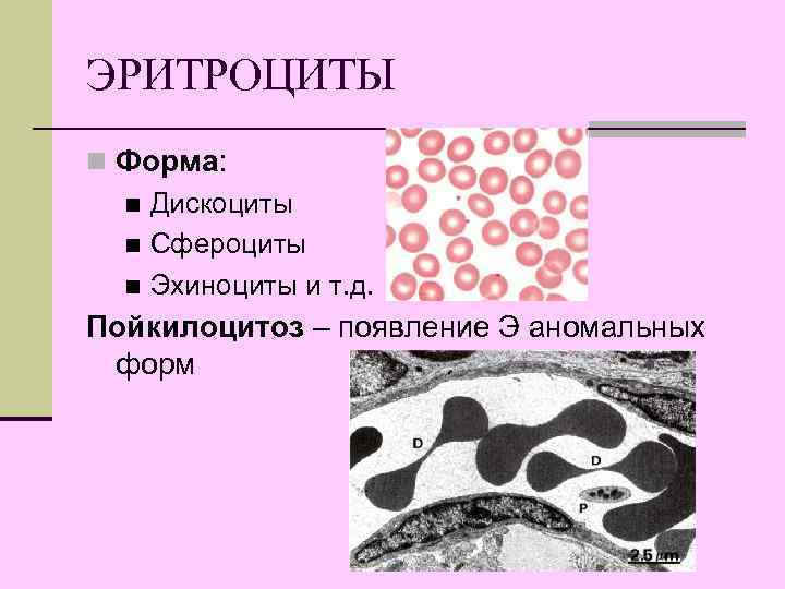 ЭРИТРОЦИТЫ n Форма:  n Дискоциты  n Сфероциты  n Эхиноциты и т.