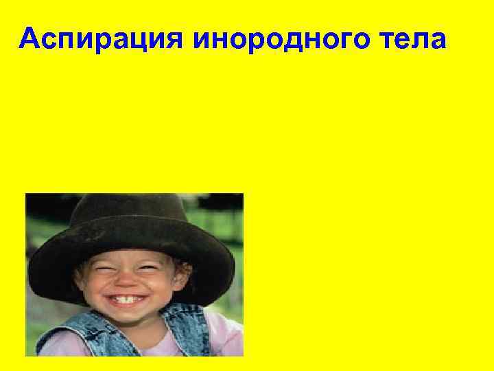 Аспирация инородного тела Инородные тела 