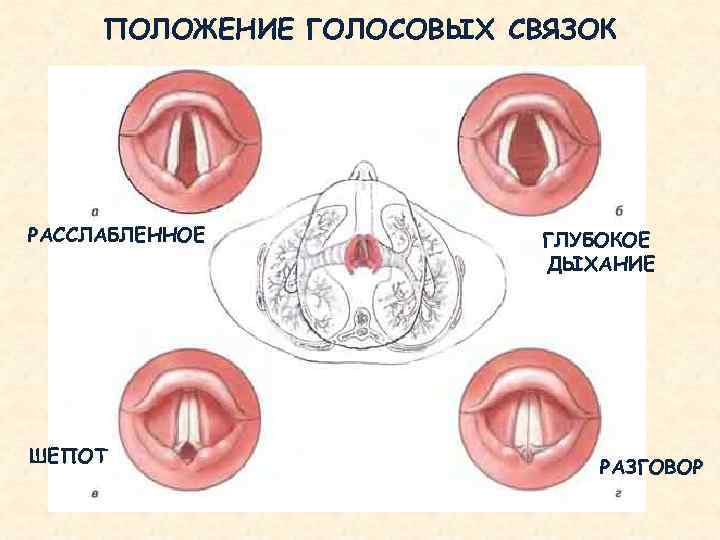 При стенозе гортани на фоне отека квинке произошла остановка дыхания необходимо