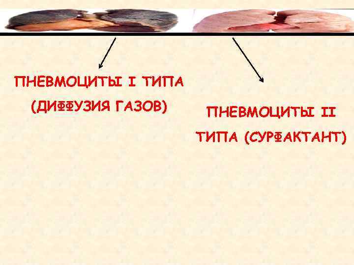 ПНЕВМОЦИТЫ I ТИПА (ДИФФУЗИЯ ГАЗОВ)  ПНЕВМОЦИТЫ II     ТИПА (СУРФАКТАНТ)
