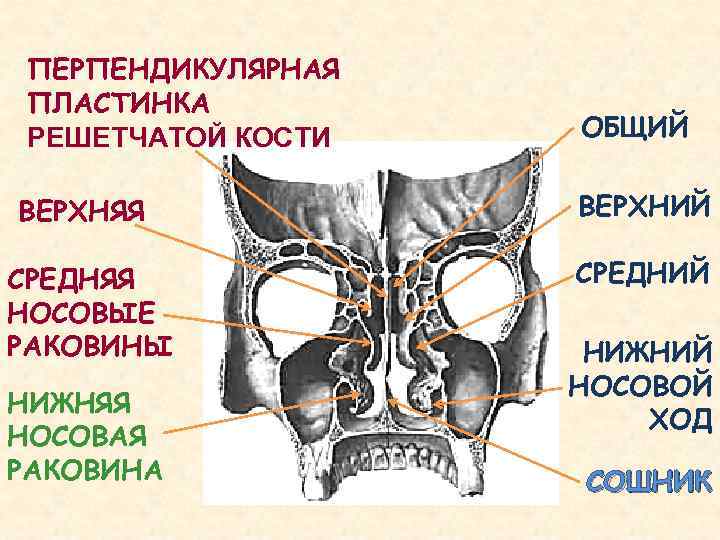  ПЕРПЕНДИКУЛЯРНАЯ ПЛАСТИНКА РЕШЕТЧАТОЙ КОСТИ  ОБЩИЙ ВЕРХНЯЯ   ВЕРХНИЙ СРЕДНЯЯ  