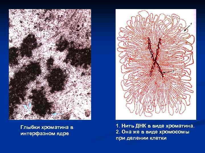 Глыбки хроматина в 1. Нить ДНК в виде хроматина. интерфазном ядре 2. Она же