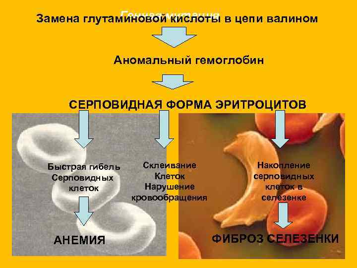 Генная кислоты Замена глутаминовоймутация в цепи валином Аномальный гемоглобин СЕРПОВИДНАЯ ФОРМА ЭРИТРОЦИТОВ Быстрая гибель