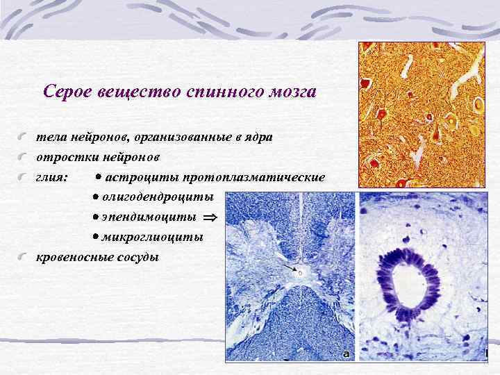 Классификация цитоморфология нейроглии спинного мозга