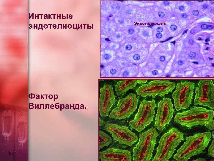 Интактные эндотелиоциты Фактор Виллебранда. Эндотелиоциты 