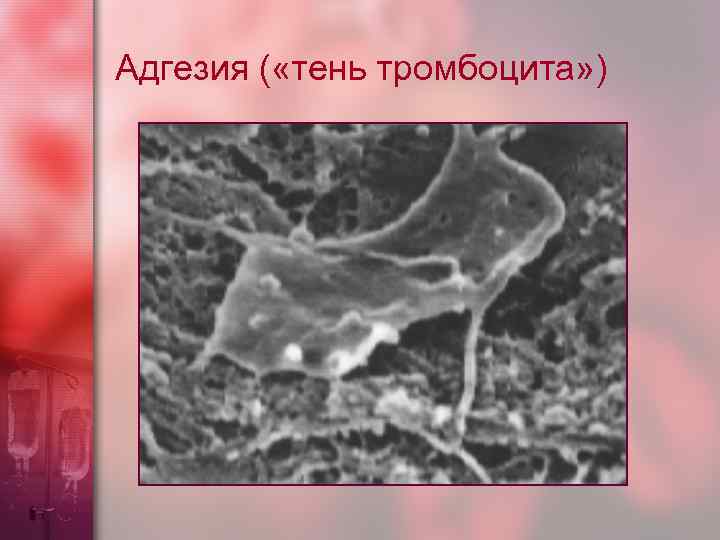 Адгезия ( «тень тромбоцита» ) 