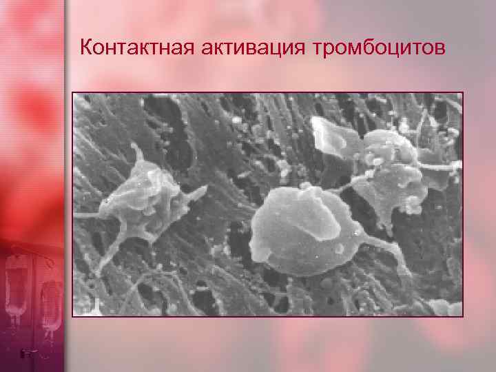 Контактная активация тромбоцитов 