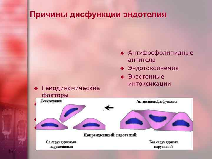 Причины дисфункции эндотелия u u u u Гемодинамические факторы Дислипопротеидемия, липопротеин (а) Гипергомоцистеинемия Гиперцитокинемия