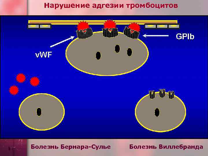 Нарушение адгезии тромбоцитов Болезнь Бернара-Сулье Болезнь Виллебранда 