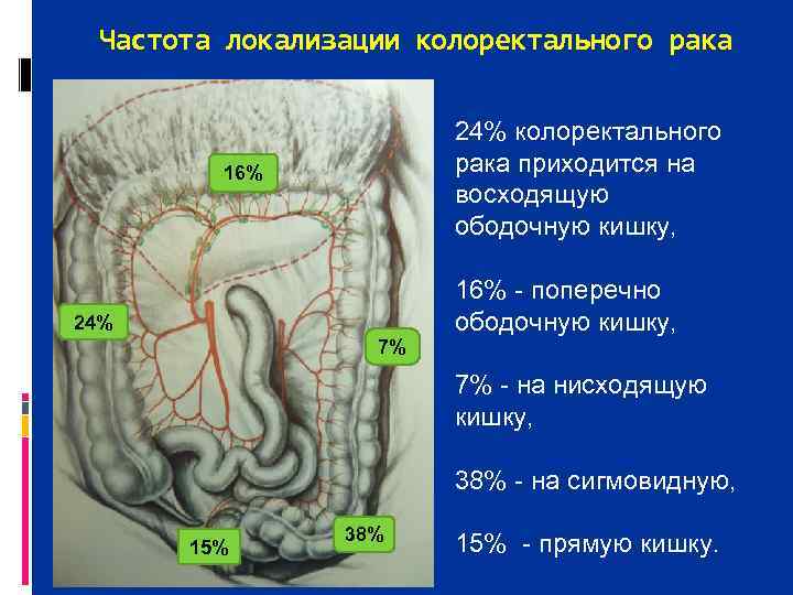  Частота локализации колоректального рака     24% колоректального  16% 