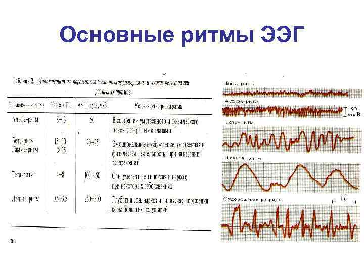 Основные ритмы ЭЭГ 