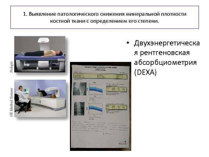 1. Выявление патологического снижения минеральной плотности костной ткани с определением его степени. • Двухэнергетическа
