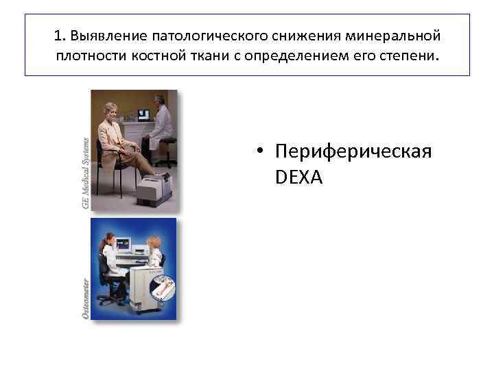 1. Выявление патологического снижения минеральной плотности костной ткани с определением его степени. • Периферическая