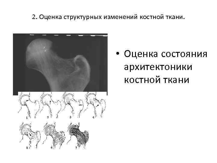 Прямое увеличение изображения достигается