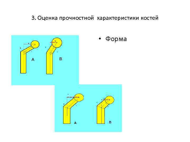 3. Оценка прочностной характеристики костей • Форма 