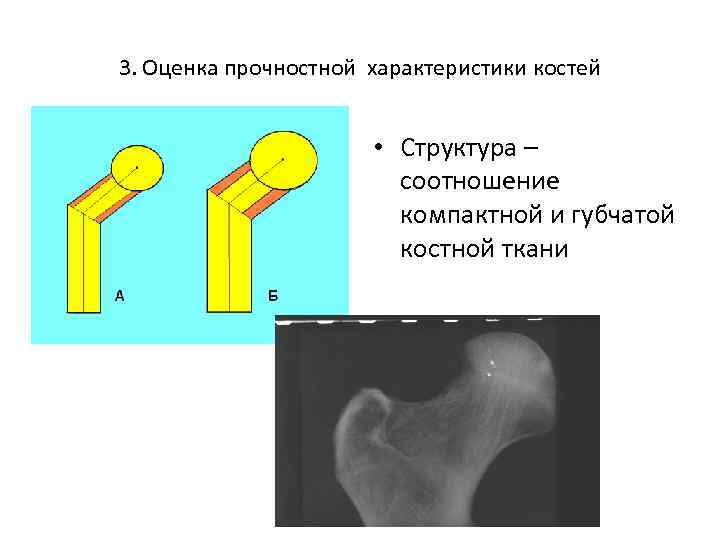 3. Оценка прочностной характеристики костей • Структура – соотношение компактной и губчатой костной ткани