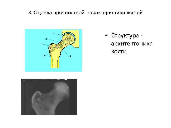 3. Оценка прочностной характеристики костей • Структура архитектоника кости 