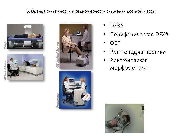 5. Оценка системности и равномерности снижения костной массы • • • DEXA Периферическая DEXA