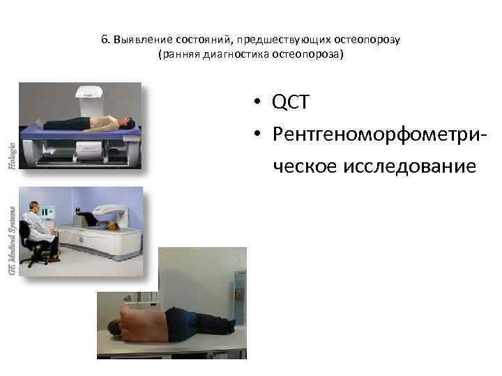 6. Выявление состояний, предшествующих остеопорозу (ранняя диагностика остеопороза) • QCT • Рентгеноморфометрическое исследование 