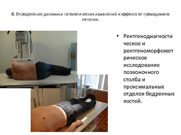 8. Определение динамики патологических изменений и эффекта от проводимого лечения. • Рентгенодиагности ческое и