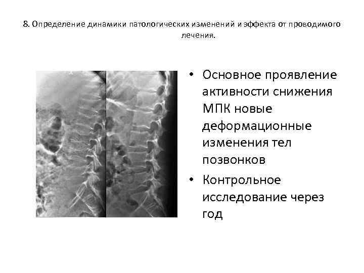 8. Определение динамики патологических изменений и эффекта от проводимого лечения. • Основное проявление активности