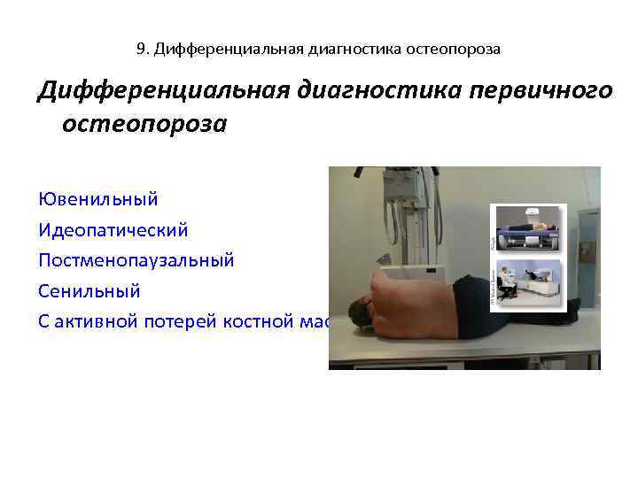 9. Дифференциальная диагностика остеопороза Дифференциальная диагностика первичного остеопороза Ювенильный Идеопатический Постменопаузальный Сенильный С активной