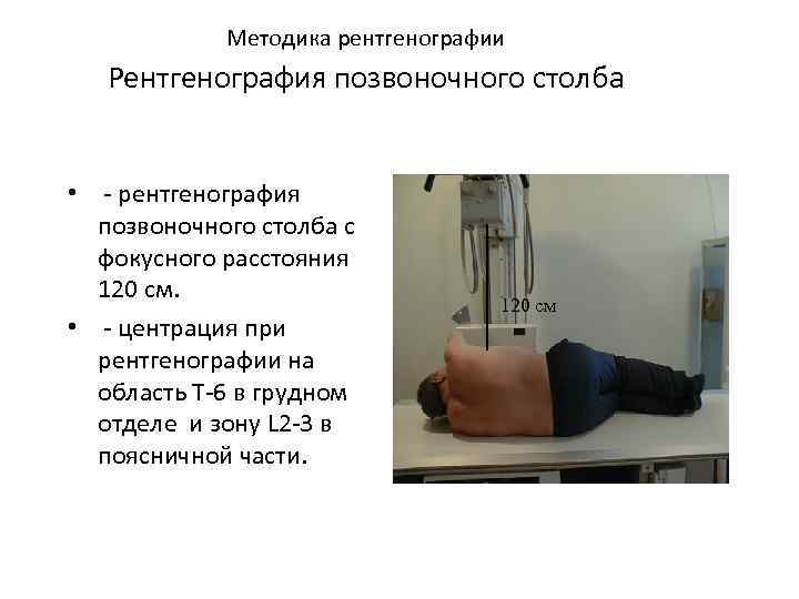  Методика рентгенографии Рентгенография позвоночного столба • - рентгенография позвоночного столба с фокусного расстояния