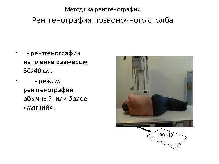  Методика рентгенографии Рентгенография позвоночного столба • - рентгенография на пленке размером 30 х40