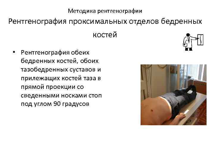  Методика рентгенографии Рентгенография проксимальных отделов бедренных костей • Рентгенография обеих бедренных костей, обоих