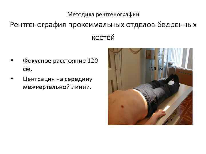  Методика рентгенографии Рентгенография проксимальных отделов бедренных костей • Фокусное расстояние 120 см. 120