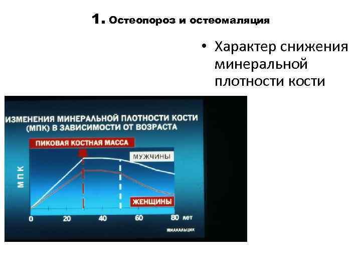1. Остеопороз и остеомаляция • Характер снижения минеральной плотности кости 
